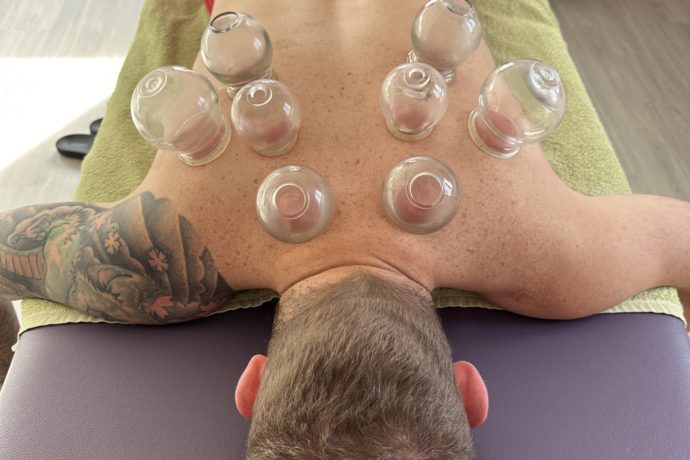 Massages aux ventouses chinoises